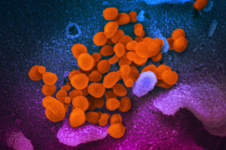 Modeling of Human Myocyte Active Contraction: A Review
